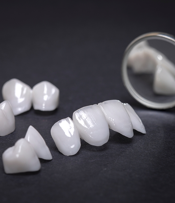 Several white veneers on a table next to a dental mirror