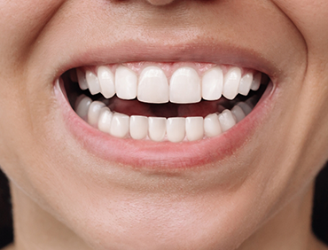 Close up of a smile with healthy looking gums and teeth