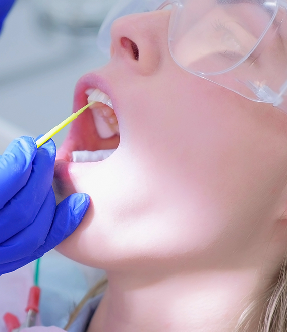 Dental patient having fluoride applied to their teeth