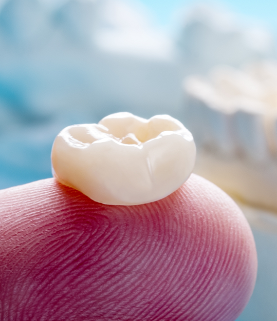 Close up of a white dental crown on a finger