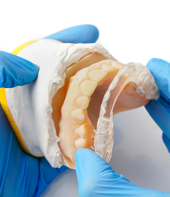 Dentist placing a clear tray over a row of teeth in a model of the mouth