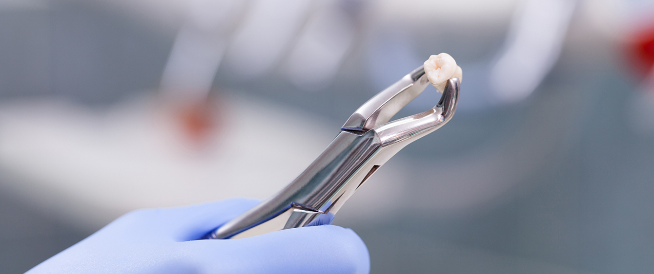 Dentist holding a clasp with an extracted tooth