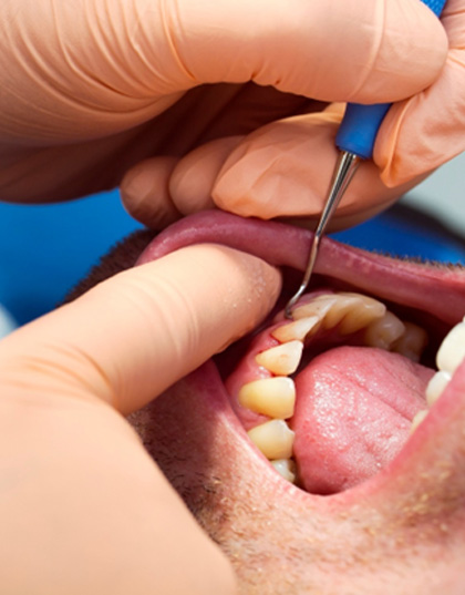 Dentist treating patient with gum disease